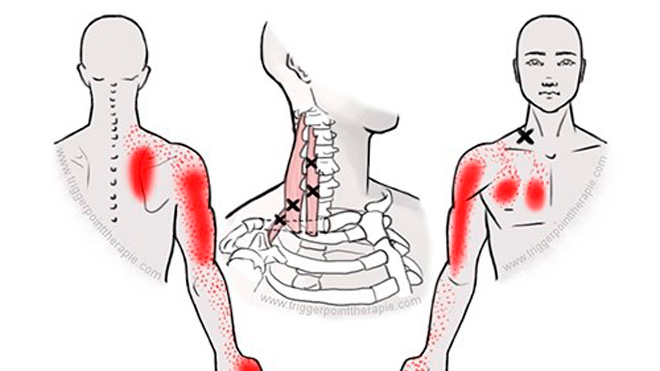Onverklaarbare pijn op de borst